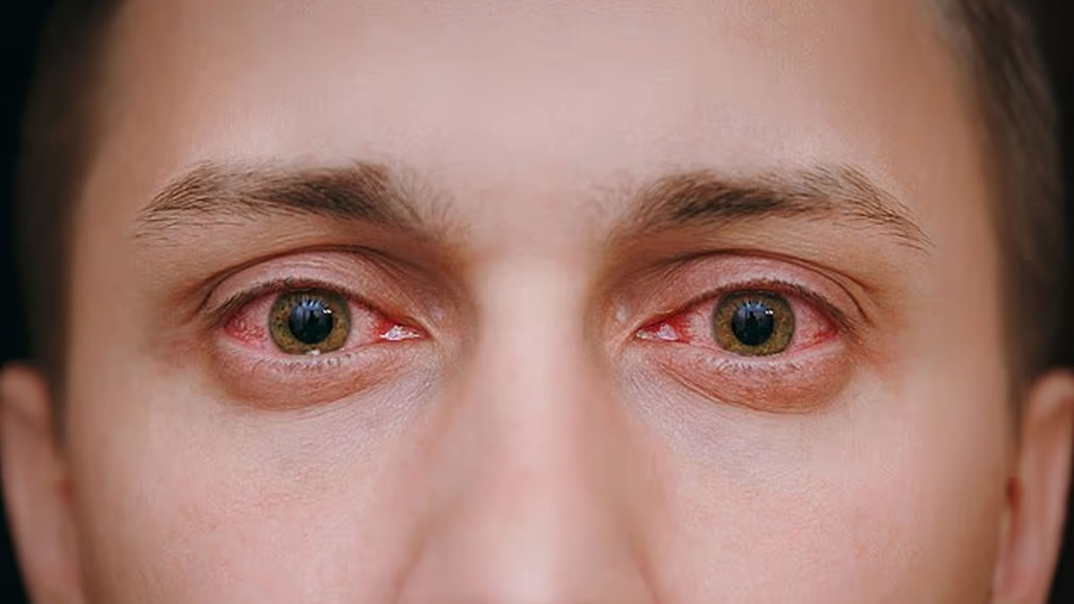 How Can You Spot the Telltale Signs of Drug Abuse in a Loved One?