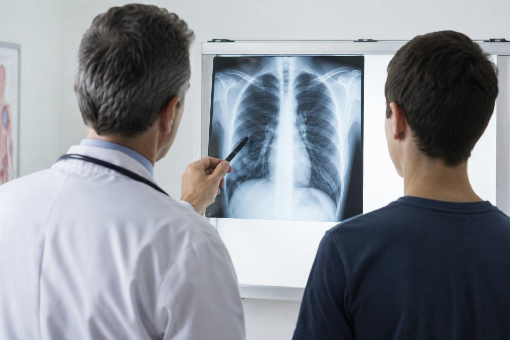 Vaping Lung Damage in Teens: Even Brief Exposure Causes Injury